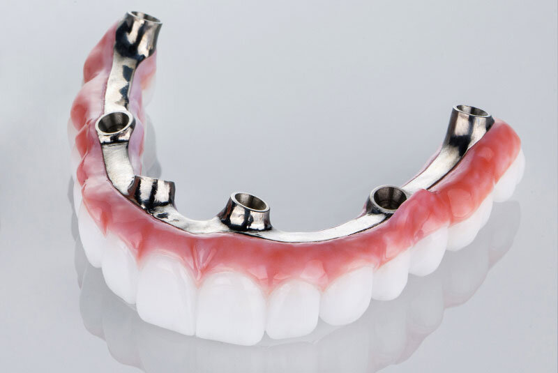 Full zirconia bridge